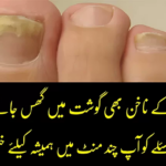 Nail-Fungus-Treatment-at-Home-in-Urdu_png