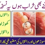 Tooth-Decay-Prevent-Gum-Disease
